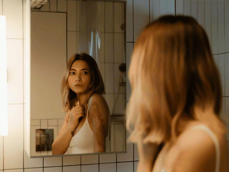 Những vết sẹo khiến chúng ta trở nên tự ti